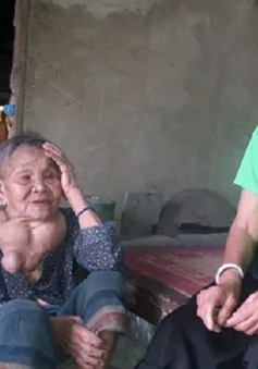 Cụ bà 80 tuổi mang khối u “khổng lồ”