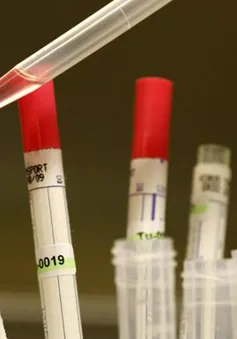 Mỹ gửi thuốc thử nghiệm điều trị Ebola tới Liberia