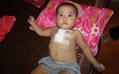 Xót xa cháu bé 2 tuổi mang nhiều căn bệnh quái ác
