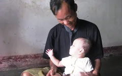 Bé 2 tuổi mơ tìm lại ánh sáng cho đôi mắt