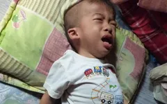 Bé 3 tuổi nguy kịch vì mắc bệnh u nguyên bào thần kinh