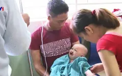 Phẫu thuật sứt môi hở vòm miễn phí cho trẻ em miền Trung