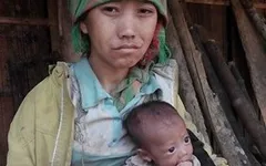 Xót xa hoàn cảnh bé 3 tháng tuổi da bọc xương vì đói sữa