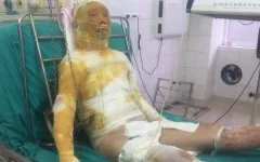 Hoàn cảnh đáng thương của cô công nhân may bị chồng thiêu sống