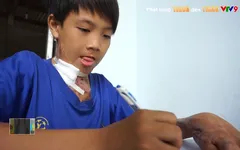 Cảm thương số phận thiệt thòi của cậu bé "cóc"