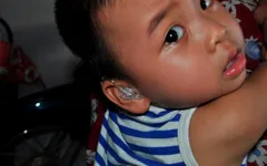Xót thương cháu bé 2 tuổi bị tổn thương não và mất thính lực nặng