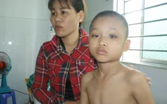 Bị vẹo cột sống, bé trai 10 tuổi có nguy cơ yếu hai chân, ngồi không được