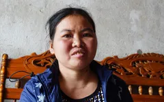 Khốn khổ người phụ nữ mắc bệnh lupus ban đỏ “gánh” cả nhà “ra ngẩn vào ngơ”