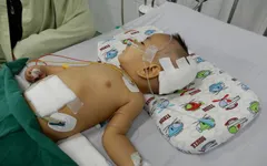 Thương cháu bé 11 tháng tuổi bị não úng thủy