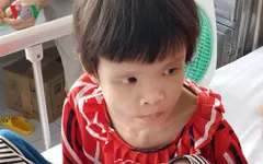 Xót xa hình ảnh da bọc xương của bé gái 15 tuổi mắc "quái bệnh"