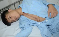 Không có tiền mổ tim lần 3, tính mạng chàng thanh niên dân tộc Thái nguy kịch