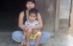 Bé 4 tuổi nguy kịch vì u nguyên bào võng mạc