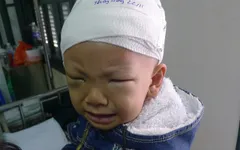 Đau đớn cảnh mẹ ung thư hạch, con ung thư võng mạc