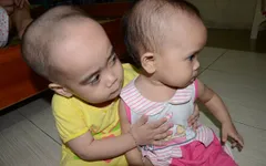 Thương 2 chị em mắc đa dị tật, suy giảm miễn dịch bẩm sinh