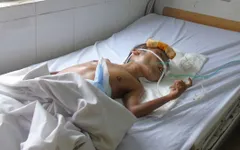 Sự sống mong manh của người đàn ông tàn tật 40 tuổi nặng 5kg