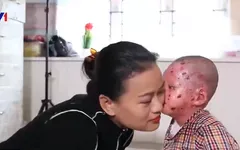 Việc tử tế: Người mẹ của những đứa con ly thượng bì bóng nước