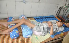 Nhiễm trùng uốn ván, tính mạng cậu bé học lớp 6 nguy kịch