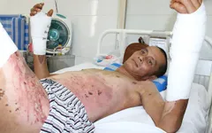 Cha nguy kịch vì bỏng điện, bầy con thơ đói khát