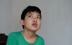 Thương cậu bé không cha đối mặt với nguy cơ biến mất cả hàm răng