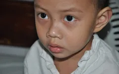 Bố chết, mẹ bỏ đi, bé 4 tuổi dân tộc Tày nguy kịch tính mạng vì viêm khớp gối