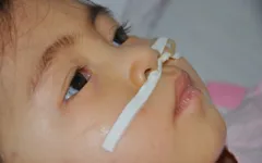Ám ảnh ánh mắt bé 3 tuổi bị viêm não