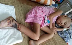 Thương bé gái người Tày vừa bị ung thư máu vừa hoại tử chân