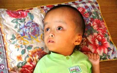 Xót xa bé gái 3 tuổi mắc bệnh não úng thủy nằm chờ chết ở nhà tình thương