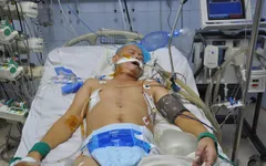 Tắc mạch phổi, tính mạng của người bố nghèo nguy kịch