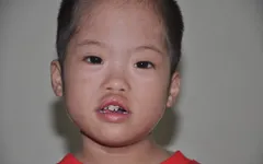 Không vay nổi 20 triệu đồng, tính mạng bé 3 tuổi nguy kịch vì bệnh tim