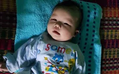 Dị tật không lá lách, tim bẩm sinh, bé trai 4 tháng nguy kịch