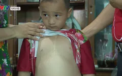Hỗ trợ phẫu thuật tim miễn phí cho bệnh nhi nghèo 6 tuổi