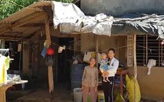 Bệnh nhi tim bẩm sinh 1 tuổi cần được hỗ trợ phẫu thuật gấp