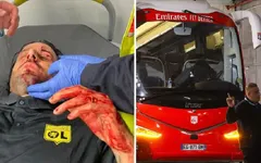 HLV Fabio Grosso của Lyon chấn thương vì bị CĐV ném đá
