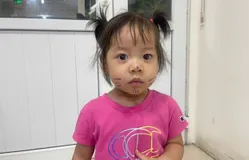 Cháu bé ở Hải Phòng mắc bệnh tim bẩm sinh đã được ra viện