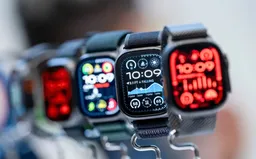 Apple Watch sắp có camera