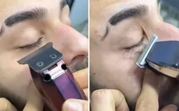 Hiểm họa tiềm ẩn từ trào lưu cạo sạch lông mi của nam giới