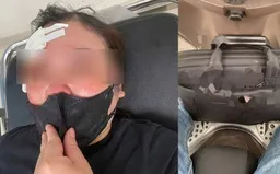 Dùng gậy sắt chọc vào mặt người phụ nữ do mâu thuẫn giao thông ở Hà Nội