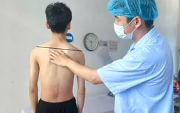 Vietnam performs first scoliosis surgery using vertebral body tethering