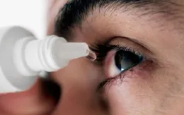 Đau mắt đỏ: Nguyên nhân và cách phòng bệnh