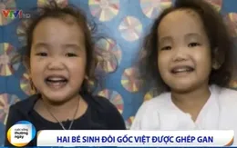 Canada: Hai bé sinh đôi gốc Việt được ghép gan