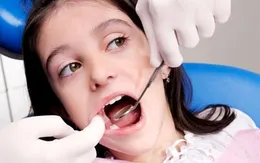 Cách phòng tránh sâu răng ở trẻ em