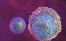 Triệu chứng nhận biết bệnh lupus ban đỏ