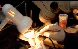 Dùng tia laser chữa lành vết thương