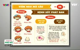 Bệnh viêm não mô cầu có thể gây tử vong hoặc di chứng nghiêm trọng