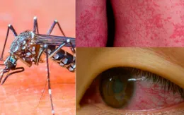 Đối phó virus Zika bằng bột giặt cải tiến và cá bảy màu