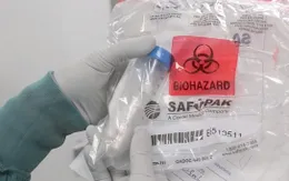 Canada thử nghiệm xác định ca nhiễm Zika qua đường tình dục