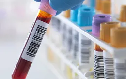 Xét nghiệm máu để phát hiện ung thư trước… 10 năm
