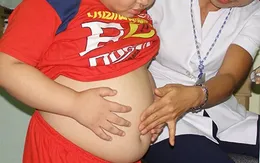 Béo phì - Nguy cơ cao gây bệnh ở trẻ