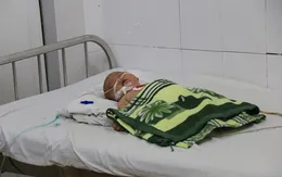 Bé trai 5 tháng tuổi mắc bệnh viêm não mô cầu