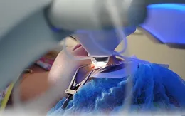 Lựa chọn phương pháp khi mổ cận thị